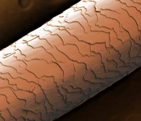 Colorized Scanning Electron Microscope image of hair