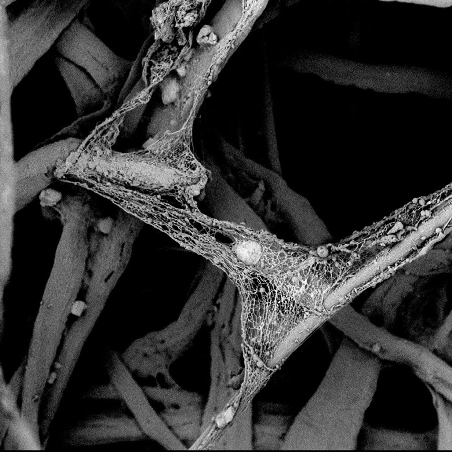 Another SEM image of a Defective pulse cleaned air filter