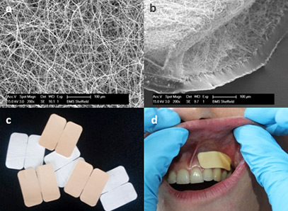 Electrospun rivelin patches