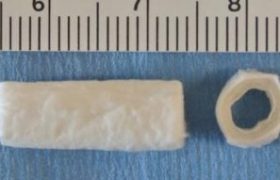 Electrospun tubular shaped scaffolds