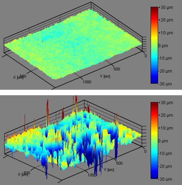 Results of Attension Theta Flex Topography Module