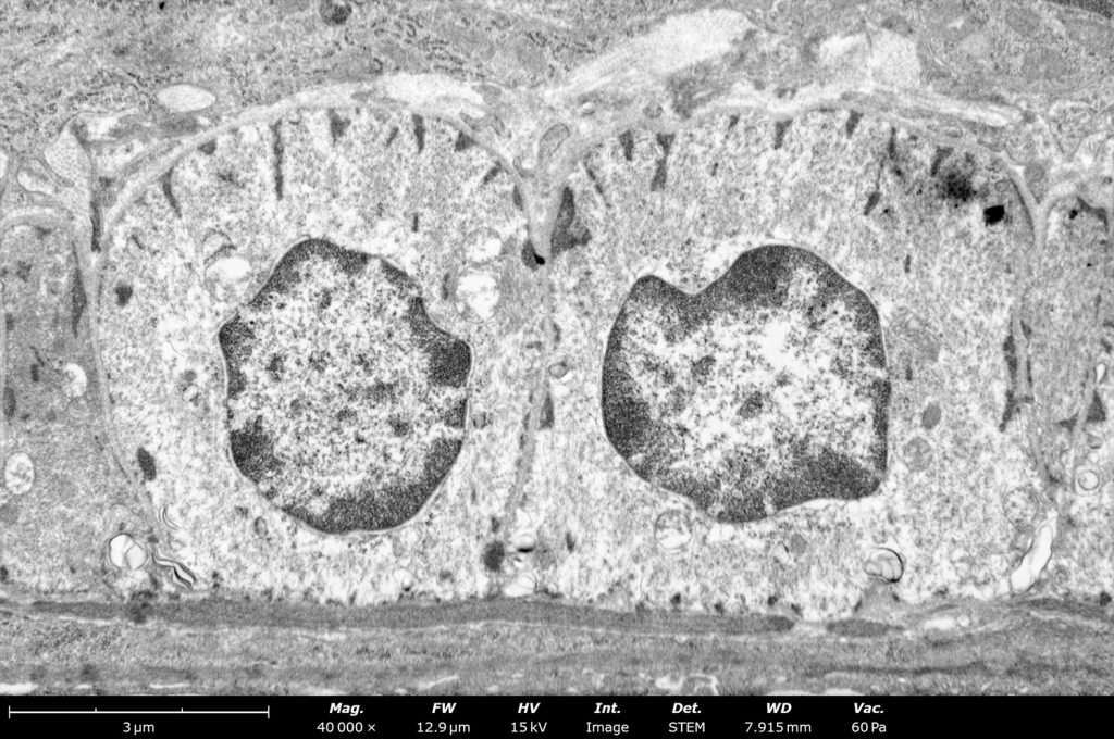 Tissue Section Analysis with Benchtop STEM | Nanoscience Instruments