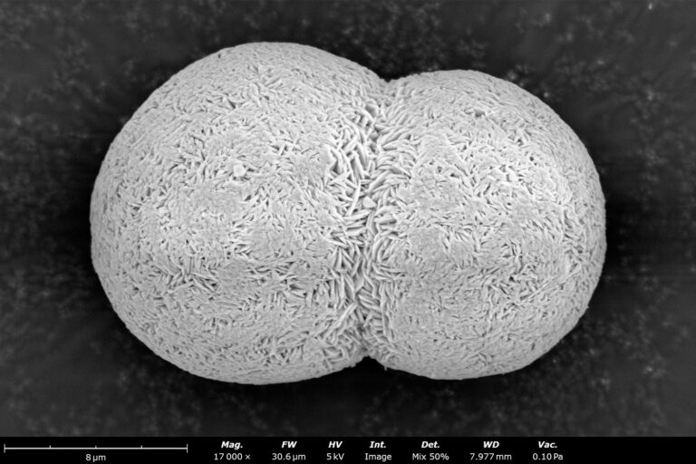 Understanding NMC Precursor Cathode Active Material (pCAM)